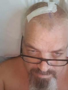 Man in hospital bed with head bandage after brain surgery.