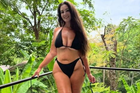I’m a size 20 with Shaughna Phillips’ leg condition – strangers poke & tell me to lose weight…how to know if you have it