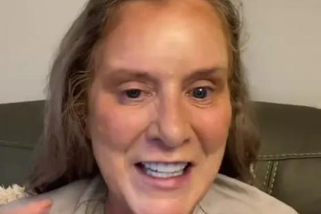 I’m begging others not to get Turkey teeth – I’m on my 2nd set & botched with receding gums after nearly losing them all