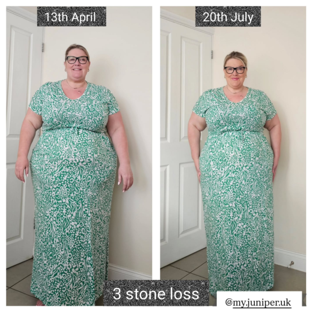 Before and after photos showing a 3 stone weight loss.