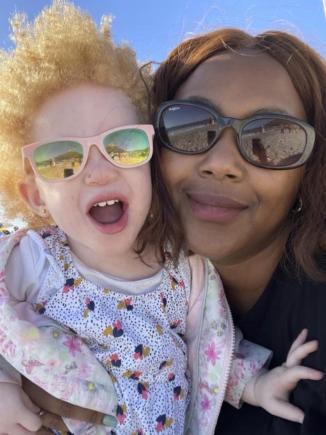 Close-up of a mother and her young daughter with albinism.