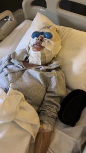 Mum’s £5.5k facelift goes viral after surgery left her unable to function solo, with people asking ‘is she alive?’