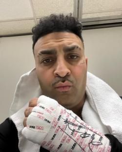 Man with hand wrapped in white athletic tape.