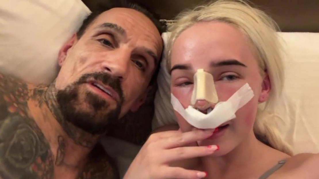 A tattooed man with a beard and a blonde woman with surgical dressing on her nose, both lying on pillows.