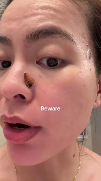 Person with pimple patches on their face; warning.