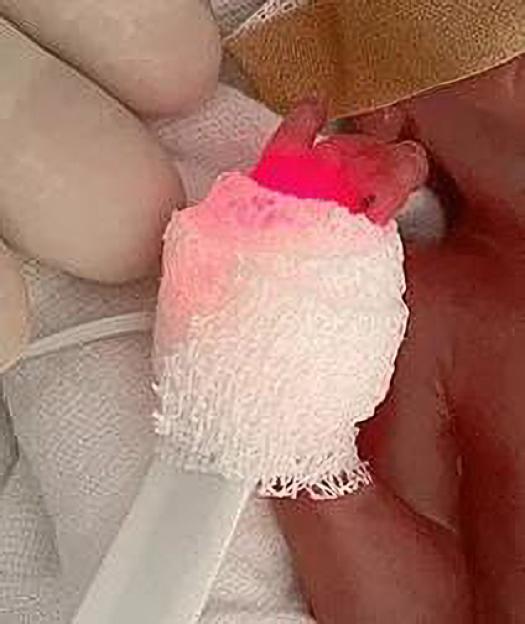 NINTCHDBPICT001036103260