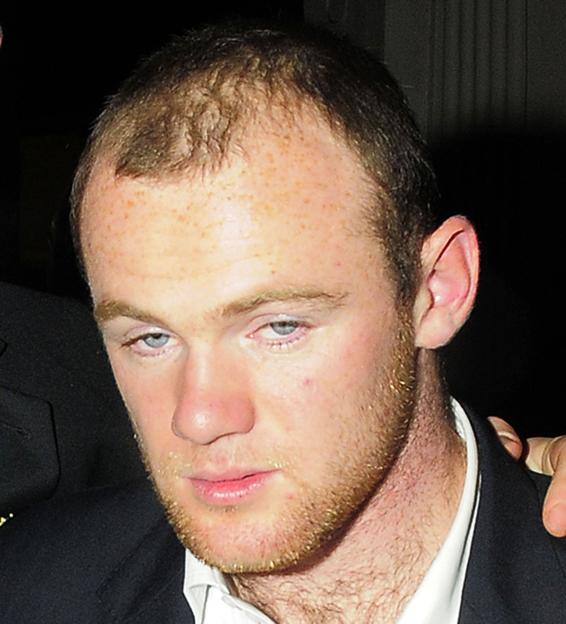 Wayne Rooney looking tired.