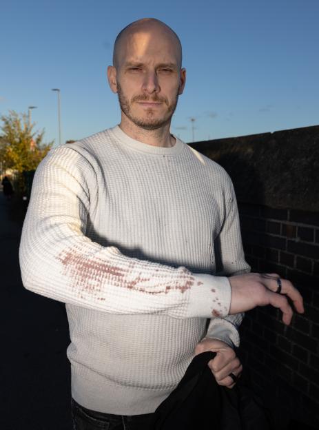 Andy Gray, 37, with a blood-stained sleeve, after helping a passenger during the Huntingdon train attack.