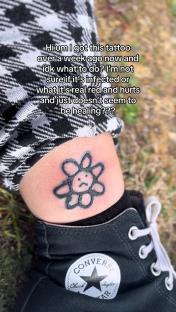 Photo of a flower tattoo on a person's leg that appears to be infected.