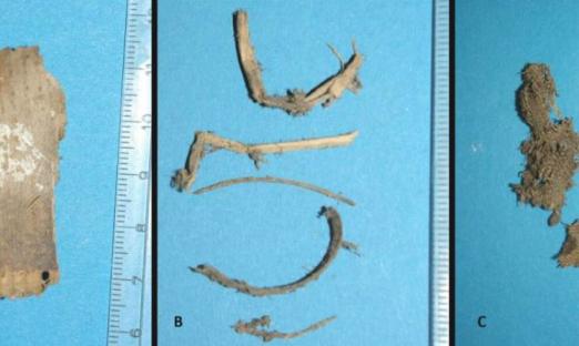Collage of three images showing fragments from an Austrian mummy.