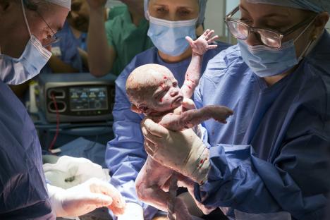 Surgeons holding a newborn baby after a womb transplant.