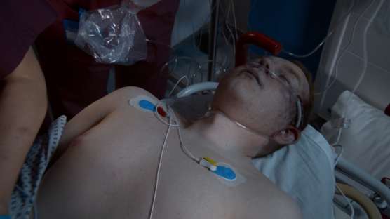 A patient in a hospital bed with medical sensors attached to his chest.