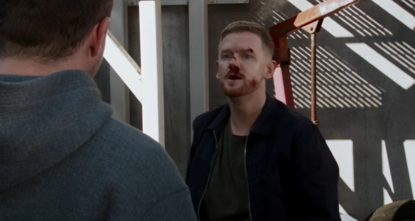 Screenshot of a man with a bloody nose speaking to another man.