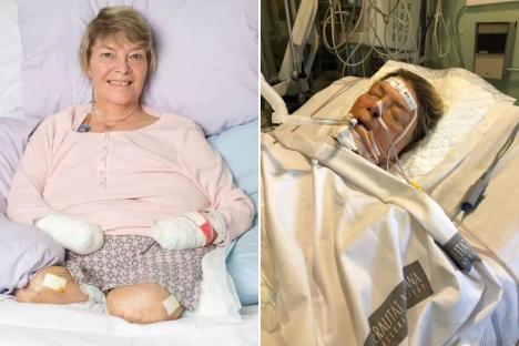Mum’s urgent warning after innocent UTI led to life-threatening condition – and all four of her limbs being amputated