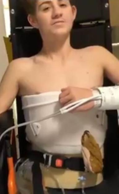 Teenager Loren Schauers who lost his lower body in a forklift accident.