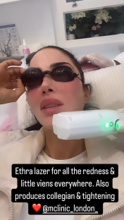 Woman receiving laser treatment.
