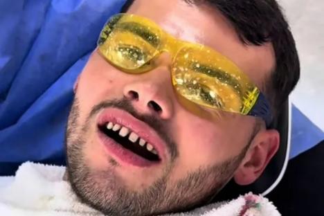 Towie’s Joe Blackman shares gruesome snaps of teeth ground down to bloody stumps ahead of getting new Turkey teeth