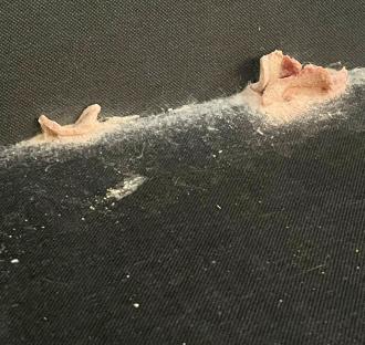 Mould growing on a dark wall.