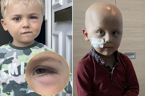 My toddler’s symptom was fobbed off as ‘holiday hay fever’ – I was horrified when the real cause was discovered