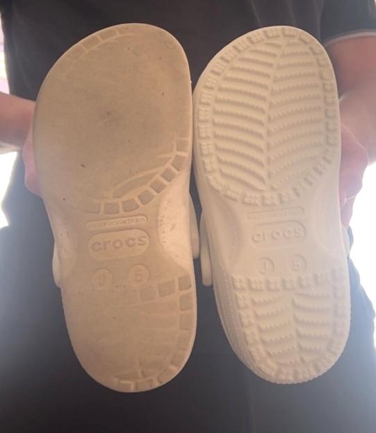 Pic from Kennedy News & Media (Pictured: FROM LEFT TO RIGHT: A PHOTO SHOWING THE GRIP ON THE BOTTOM OF 21-YEAR-OLD JESSICA FOSTER'S OLD CROCS VERSUS HER NEW CROCS.) A student is warning people not to wear 'old' Crocs - after slipping at a waterpark and being rushed to hospital with cracked ribs and internal bruising. Jessica Foster, from Grimsby in Lincolnshire, visited a waterpark with her partner Chad Munslow, 26, and his family, on July 19th to enjoy a day playing on the inflatables. But when the 21-year-old left the changing rooms in her size five white Crocs she says she slipped on wet grass, twisting her left foot and smashing her lower back into a steel step.DISCLAIMER: While Kennedy News and Media uses its best endeavours to establish the copyright and authenticity of all pictures supplied, it accepts no liability for any damage, loss or legal action caused by the use of images supplied and the publication of images is solely at your discretion. SEE KENNEDY NEWS COPY - 0161 697 4266