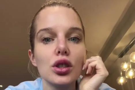 Helen Flanagan reveals scary health issue that’s left her lips ‘numb’