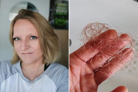 I went from a size 16 to 10 on Mounjaro but my hair fell out & ‘disgusting’ burps made my man gag – it’s not worth it