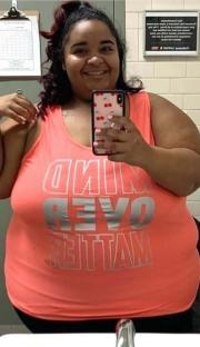 Before and after photos of a person's weight loss.