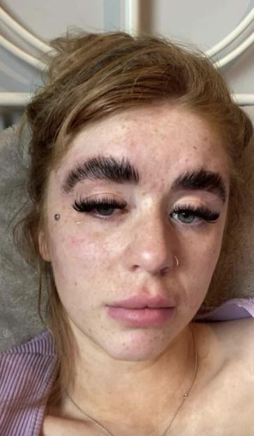 Woman with poorly laminated eyebrows.