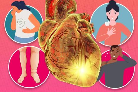 From cankles to sweaty pits – the 12 subtle signs of heart disease as deaths rise for the first time in 50 years