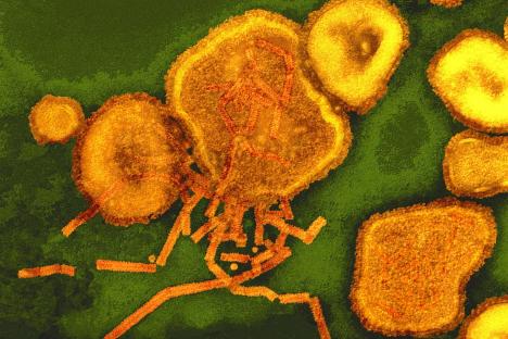 One of the UK’s most common bugs that’s mistaken for a cold ‘TRIPLES risk of death for a year after infection’