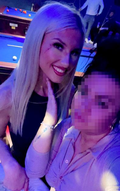 A woman with facial injuries poses for a photo with a friend.