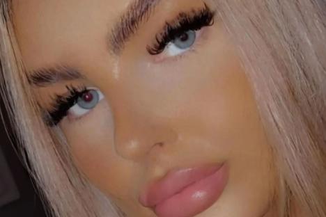 I was obsessed with filler & looking fake – trolls say I’m a ‘different person’ now and call my natural look a ‘big no’