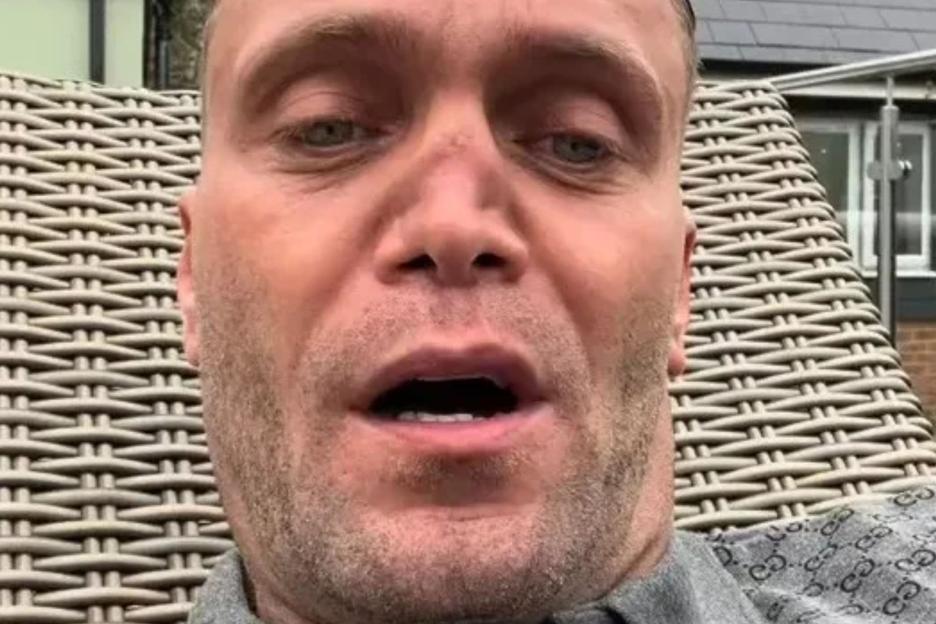 My £2.2m cocaine habit left me deaf with pieces falling out my rotted nose – I looked like I was dug up from the grave