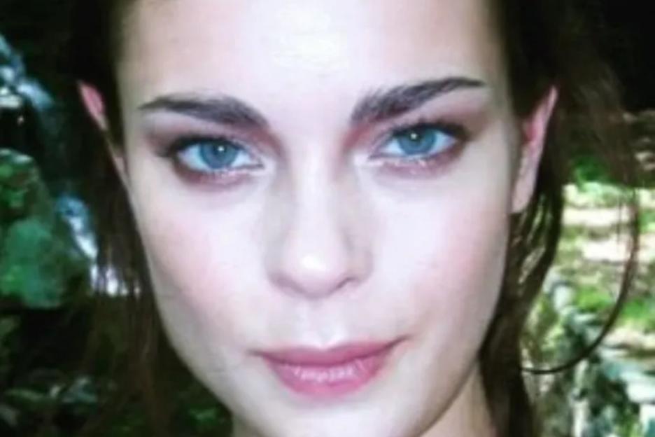 Vogue Model Turned Children's Nurse Tragically Passes Away Just Two Days After Hospital Visit for Stomach Pains