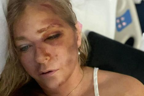 Prince Andrew sex accuser & Epstein victim says she has ‘four days to live’ after being ‘seriously injured in car crash’