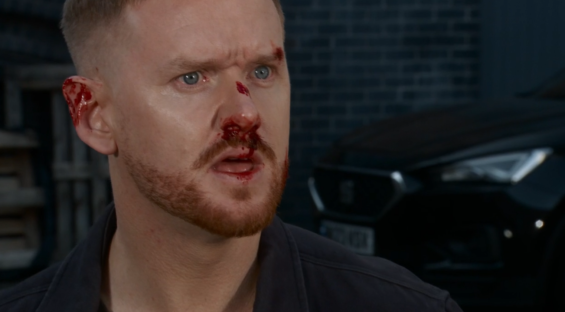 Man with bloody injuries to his face and ear.