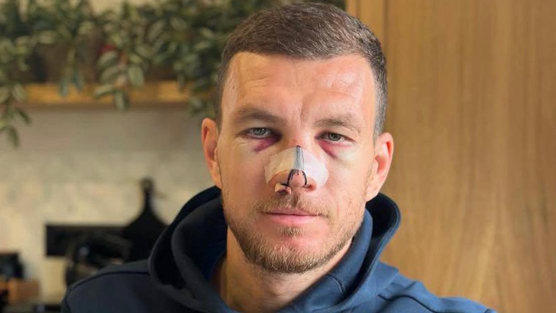Former Premier League star barely recognisable as he shows off horror injuries suffered in World Cup qualifying