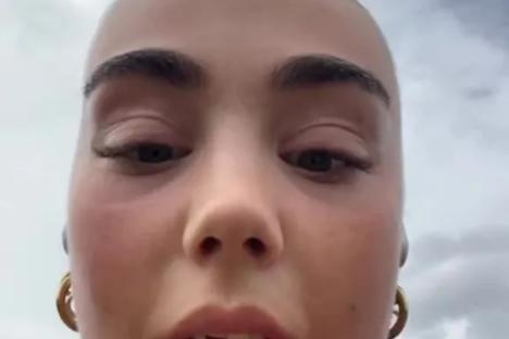 Woman tries to ‘save her nails’ while opening a can but the outcome is SO much worse than a chipped mani