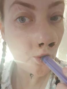 Close-up of a woman receiving an injection in her mouth.