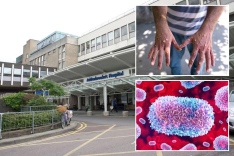 Major hospital issues warning after person with mpox visits A&E – as it rushes to identify patients and staff exposed