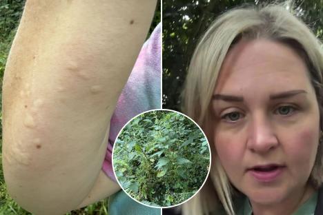 Mum reveals STINGING herself with nettles banishes hay fever symptoms ‘in minutes’ – would you try it?