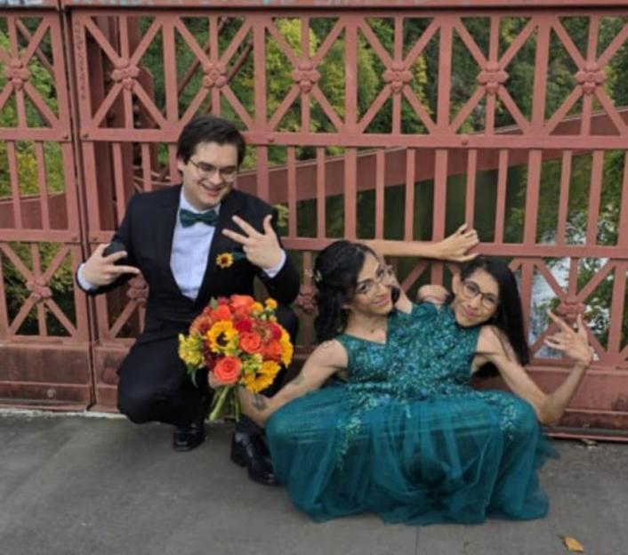 Conjoined twins Carmen and Lupita Andrade and Carmen's husband pose for a photo.