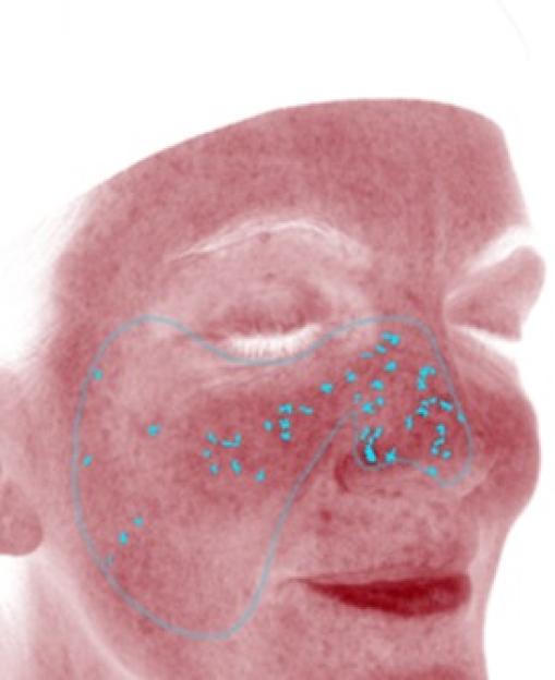 Skin analysis showing spots, wrinkles, texture, pores, UV spots, brown spots, red areas, and porphyrins; actual age 46, TruSkin Age 53.