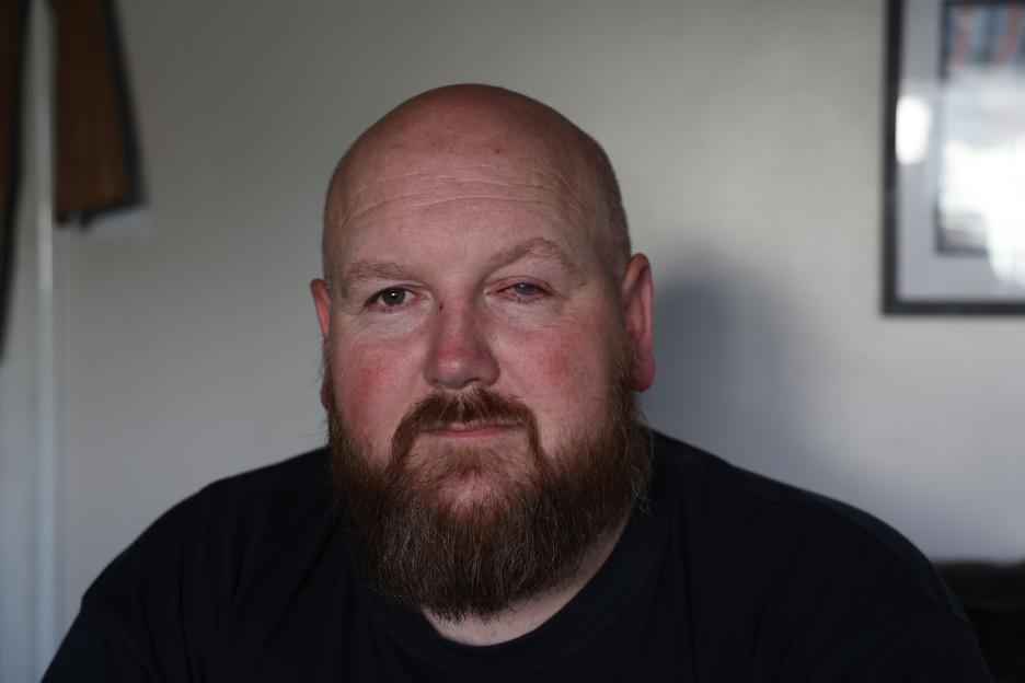 Portrait of Paul Laskey, an acid attack victim.