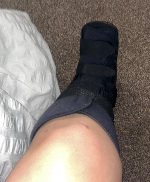 Pic from Kennedy News & Media (Pictured: 21-YEAR-OLD JESSICA FOSTER HAS BEEN LEFT WEARING A BOOT WHILE HER LEFT ANKLE HEELS.) A student is warning people not to wear 'old' Crocs - after slipping at a waterpark and being rushed to hospital with cracked ribs and internal bruising. Jessica Foster, from Grimsby in Lincolnshire, visited a waterpark with her partner Chad Munslow, 26, and his family, on July 19th to enjoy a day playing on the inflatables. But when the 21-year-old left the changing rooms in her size five white Crocs she says she slipped on wet grass, twisting her left foot and smashing her lower back into a steel step.DISCLAIMER: While Kennedy News and Media uses its best endeavours to establish the copyright and authenticity of all pictures supplied, it accepts no liability for any damage, loss or legal action caused by the use of images supplied and the publication of images is solely at your discretion. SEE KENNEDY NEWS COPY - 0161 697 4266