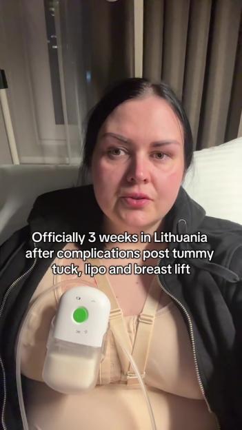 Woman in Lithuania recovering from complications after tummy tuck, liposuction, and breast lift.