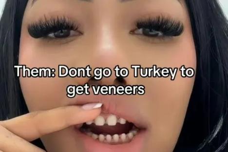 I splashed out on a set of Turkey teeth – people warned me & now trolls say I have ‘piano keys’ & ask if I can ‘undo it’