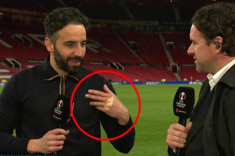 Amorim spotted with plaster on knuckles after half-time as Man Utd fans say ‘anyone checked the TVs in changing room?’