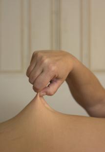A woman pinching her skin to show excess fat.