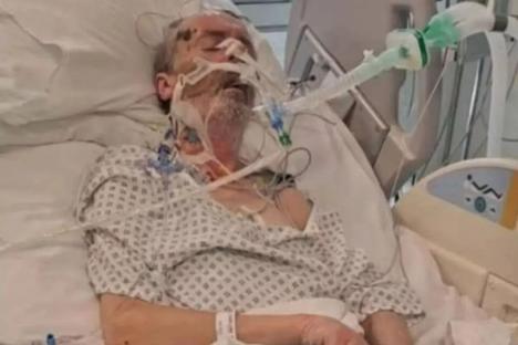 Thug told man ‘go to sleep, you c***’ before stamping on him with fake leg – leaving victim needing round-the-clock care